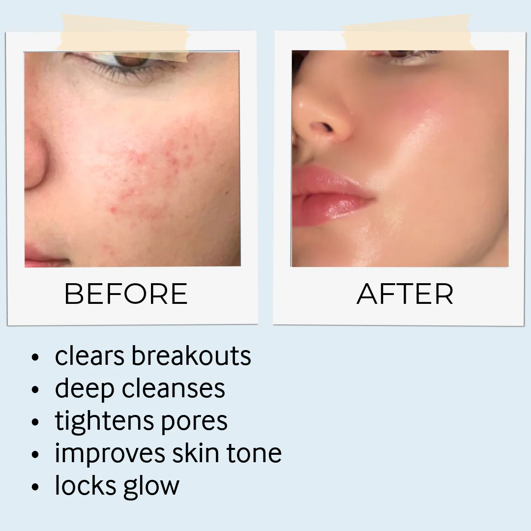 Ancient Rituals, Radiantly Perfect Skin